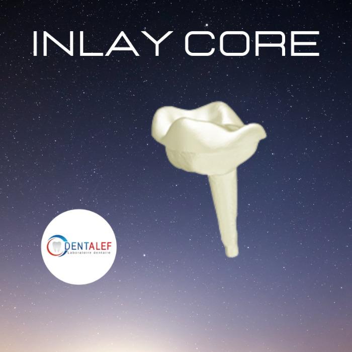 inlay core 