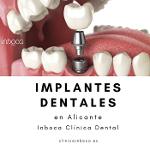 Mejores Implantes Dentales Alicante en Clínica Dental Inboca