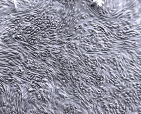 ipCELLCULTURE™ Filtros de membrana con grabado de trazas